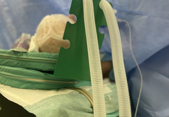 V naší nemocnici dokážou tisknout pomůcky na operační sál