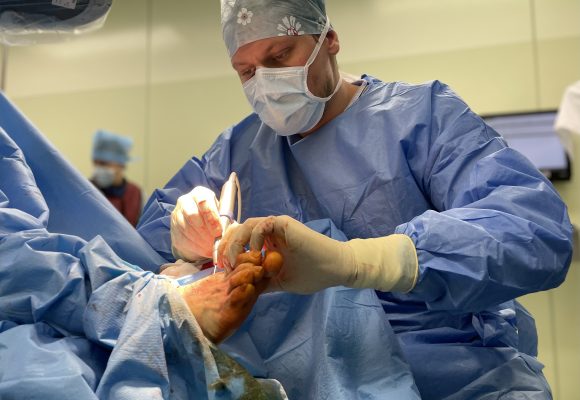 Unikátní operaci vbočených palců provádí nově ortopedi v Jihlavě