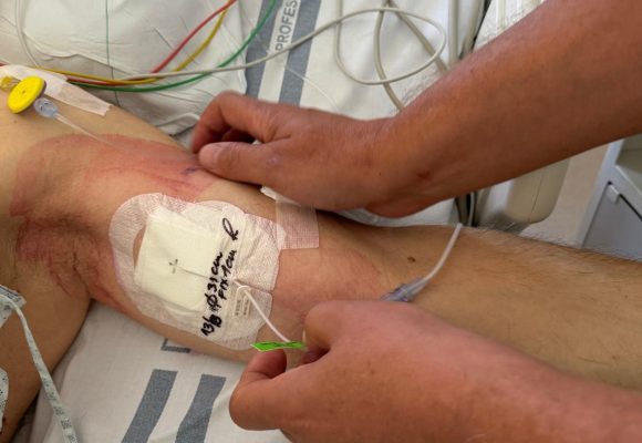 Zdravotníci nově pomůžou pacientům, které trápí rozpíchané žíly