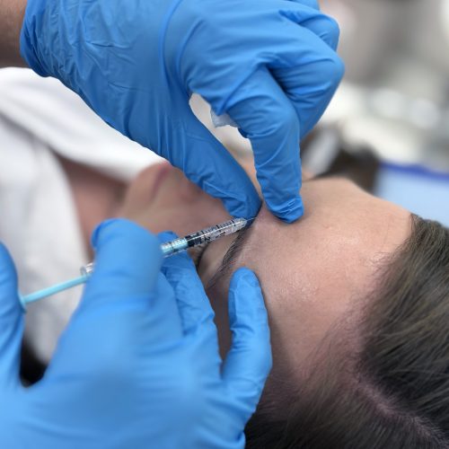 Alluzience_3 kožní