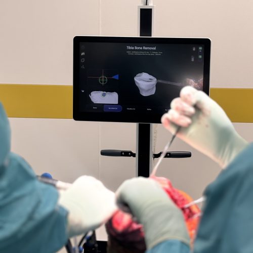 Robot 2 Lékaři jihlavské nemocnice provedli první roboticky asistovanou částečnou náhradu kolenního kloubu